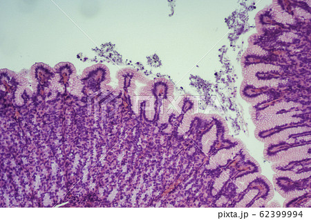 胃切片　顕微鏡写真 62399994