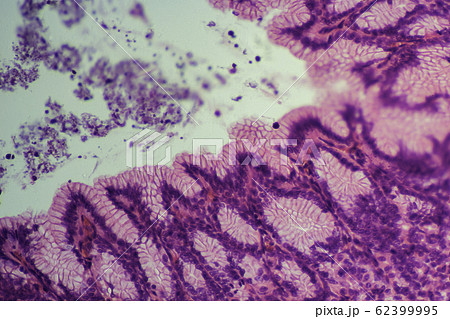 胃切片　顕微鏡写真 62399995