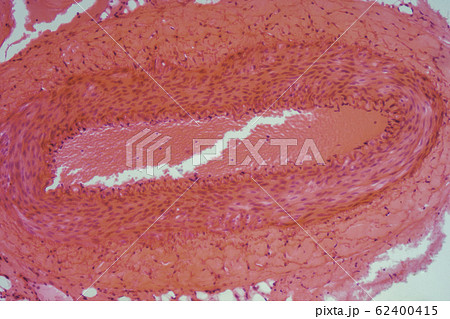 静脈血管切片　顕微鏡写真 62400415