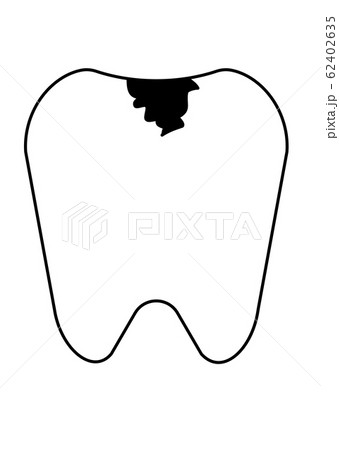 歯 虫歯 シンプルのイラスト素材