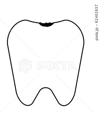 歯 虫歯なりかけ シンプルのイラスト素材