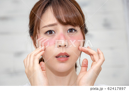日焼け 悩む女性 日焼け 悩む女性 62417897