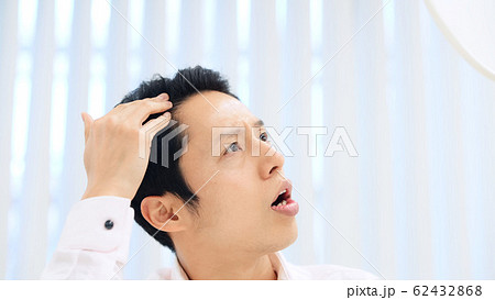 生え際を気にする男性 62432868