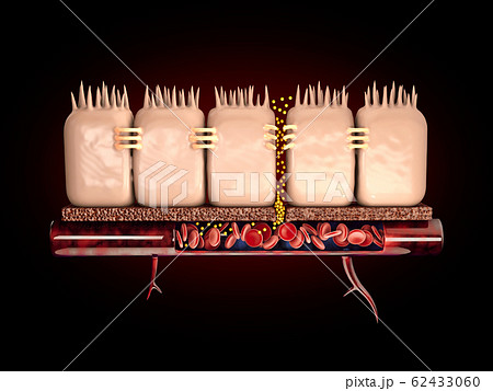 3d Rendering of leaky gut, in intestine with celiac disease and gluten sensitivity these tight 62433060