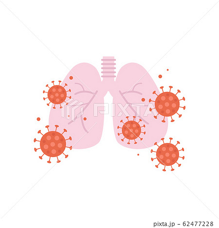 コロナウイルスと肺炎のイラストのイラスト素材