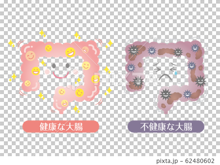 健康な大腸と不健康な大腸　腸活 62480602