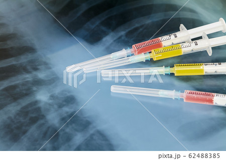 Syringes with various medicines on the background Syringes with various medicines on the background 62488385