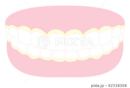 歯垢のべったりついた歯と歯茎のイラストのイラスト素材