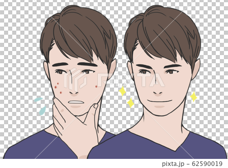 Clear acne skin! Clear acne skin! 62590019