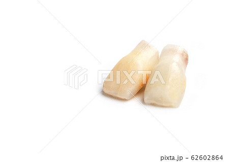 Baby teeth on a white background. Loss of two Baby teeth on a white background. Loss of two 62602864