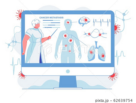 Doctor Showing Cancer Metastasis Flat Illustration 62639754