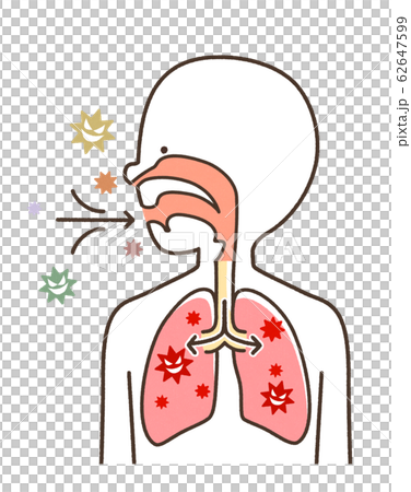 Infectious disease pneumonia cute system Infectious disease pneumonia cute system 62647599