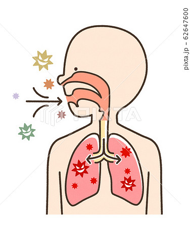 感染症 肺炎 かわいい系のイラスト素材