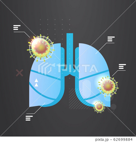 epidemic MERS-CoV floating influenza virus infected human lungs wuhan coronavirus 2019-nCoV pandemic medical health risk epidemic MERS-CoV floating influenza virus infected human lungs wuhan coronavirus 2019-nCoV pandemic medical health risk 62699884