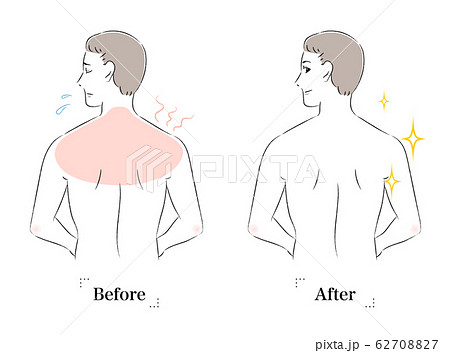 背中 肌 悩み 日焼け ビフォーアフター 男性のイラスト素材