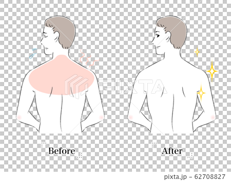 背部皮膚擔心在男性之前曬黑 背部皮膚擔心在男性之前曬黑 62708827