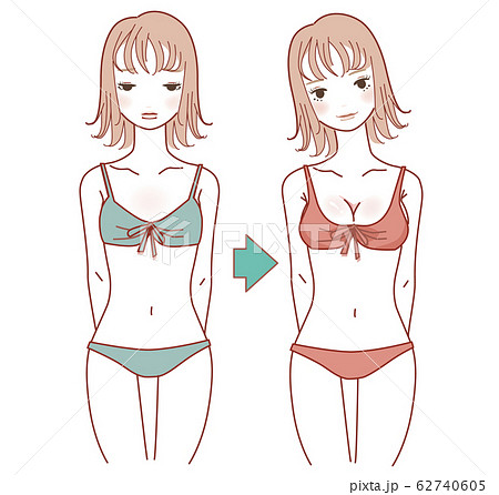 Illustration of a swimsuit before and after - Stock Illustration  [102600284] - PIXTA