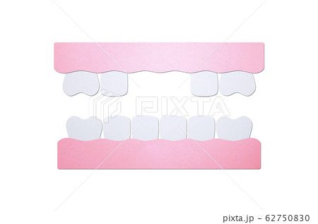 model tooth of missing teeth 62750830