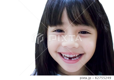 little girl showing her broken milk teeth isolated on a white background 62755249