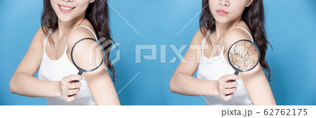 skin moisturizing care concept skin moisturizing care concept 62762175