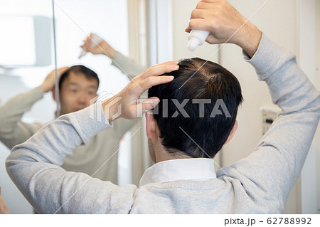 薄毛に悩む中年男性 62788992