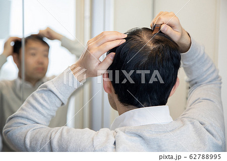 薄毛に悩む中年男性 62788995