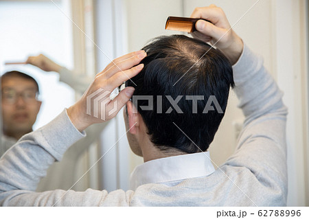 薄毛に悩む中年男性 62788996