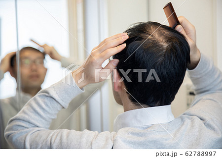 薄毛に悩む中年男性 62788997