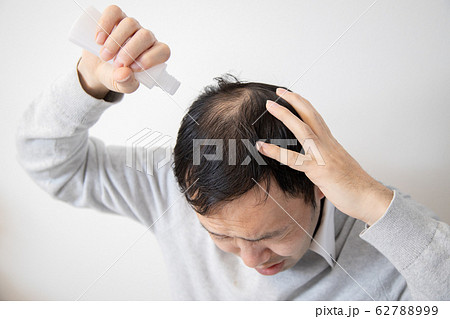 薄毛に悩む中年男性 62788999