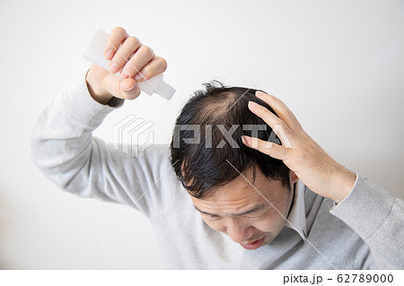 薄毛に悩む中年男性 62789000