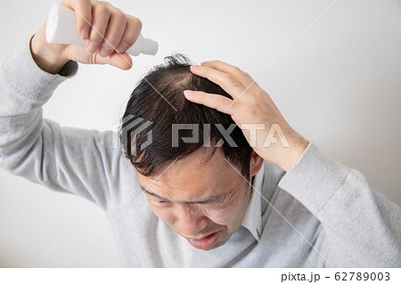 薄毛に悩む中年男性 薄毛に悩む中年男性 62789003