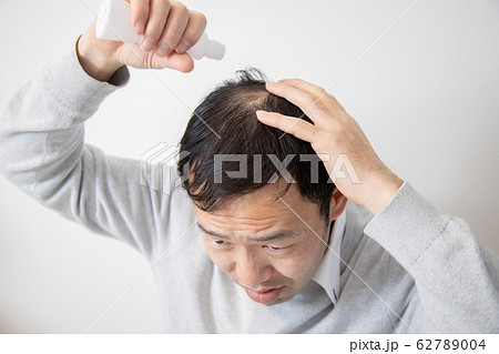薄毛に悩む中年男性 62789004