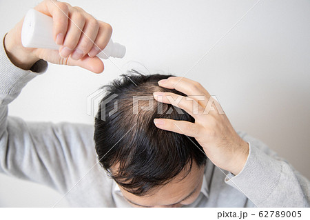 薄毛に悩む中年男性 62789005