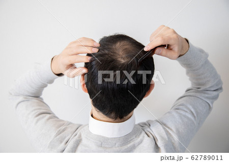 薄毛に悩む中年男性 62789011