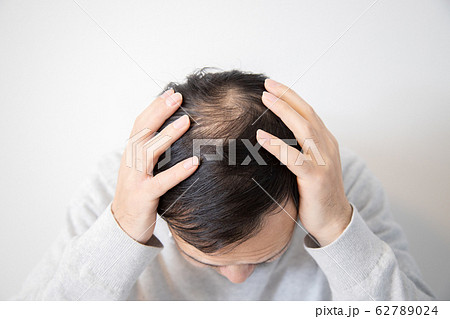 薄毛に悩む中年男性 62789024