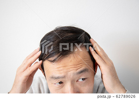 薄毛に悩む中年男性 薄毛に悩む中年男性 62789026