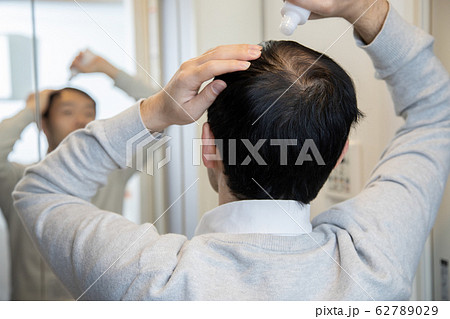薄毛に悩む中年男性 薄毛に悩む中年男性 62789029