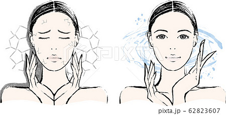 女性　乾燥肌　ビフォーアフター 62823607