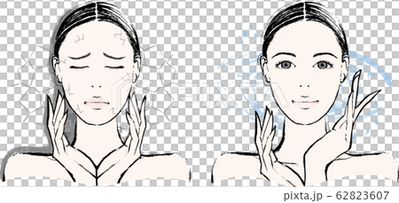 女性　乾燥肌　ビフォーアフター 62823607