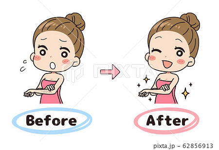 腕ムダ毛のビフォーアフターのセットイラスト　上半身 62856913