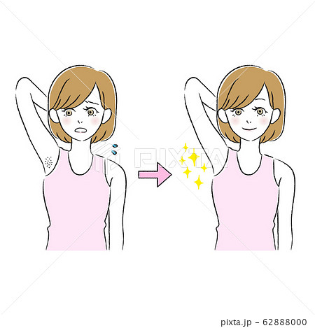 美容　ワキ　女性 62888000