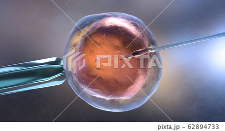 Artificial insemination or in vitro fertilization Artificial insemination or in vitro fertilization 62894733