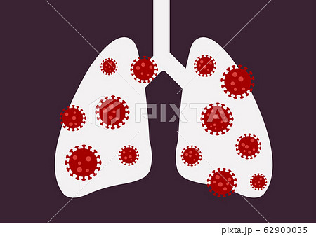 Covid-19 or Corona Virus in Human Lung and Covid-19 or Corona Virus in Human Lung and 62900035