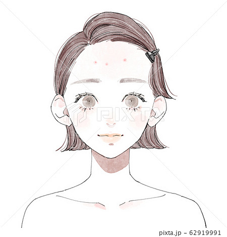 ニキビ肌の女性 おでこ のイラスト素材