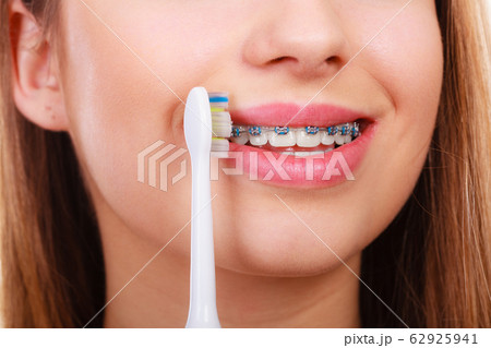 Woman brushing teeth with braces using brush 62925941
