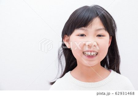 歯の矯正をする小学生の女の子 歯の矯正をする小学生の女の子 62931468