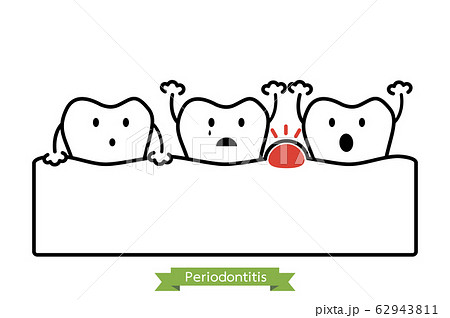 periodontitis or gum disease with swell ( gum and tooth is swollen because inflammation ) periodontitis or gum disease with swell ( gum and tooth is swollen because inflammation ) 62943811