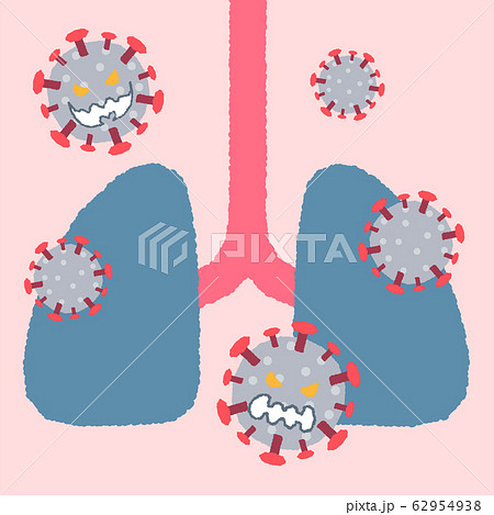 ウイルスに侵された肺 ウイルスに侵された肺 62954938