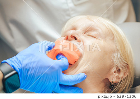 Prosthetics of the removable jaw of an elderly 62971306