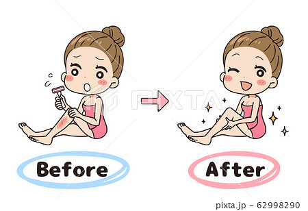 カミソリ負けのビフォーアフターのセットイラスト 全身図のイラスト素材